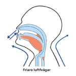 Illustration som visar friare luftvägar med sovkrage mot snarkning